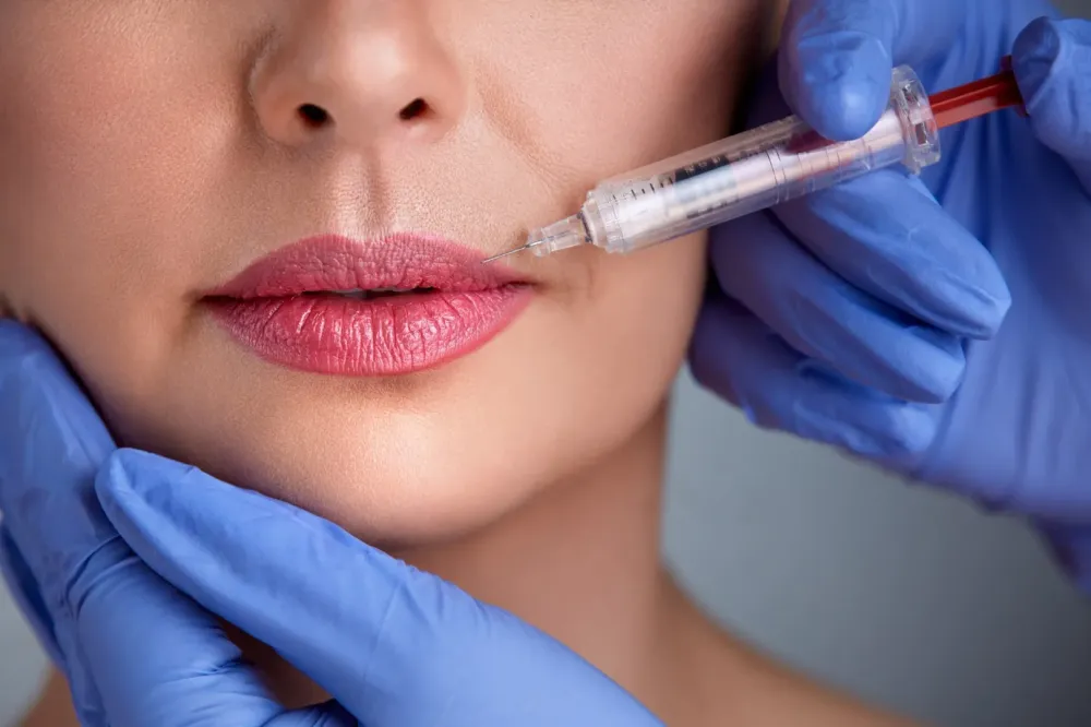 injection dans les lèvres