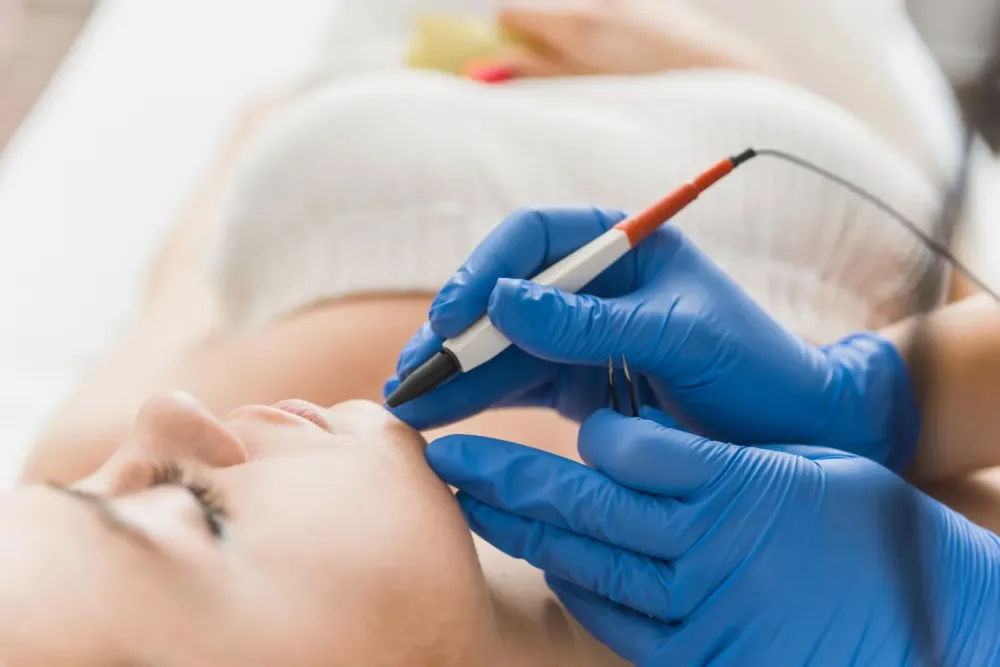 Epilation Apilus